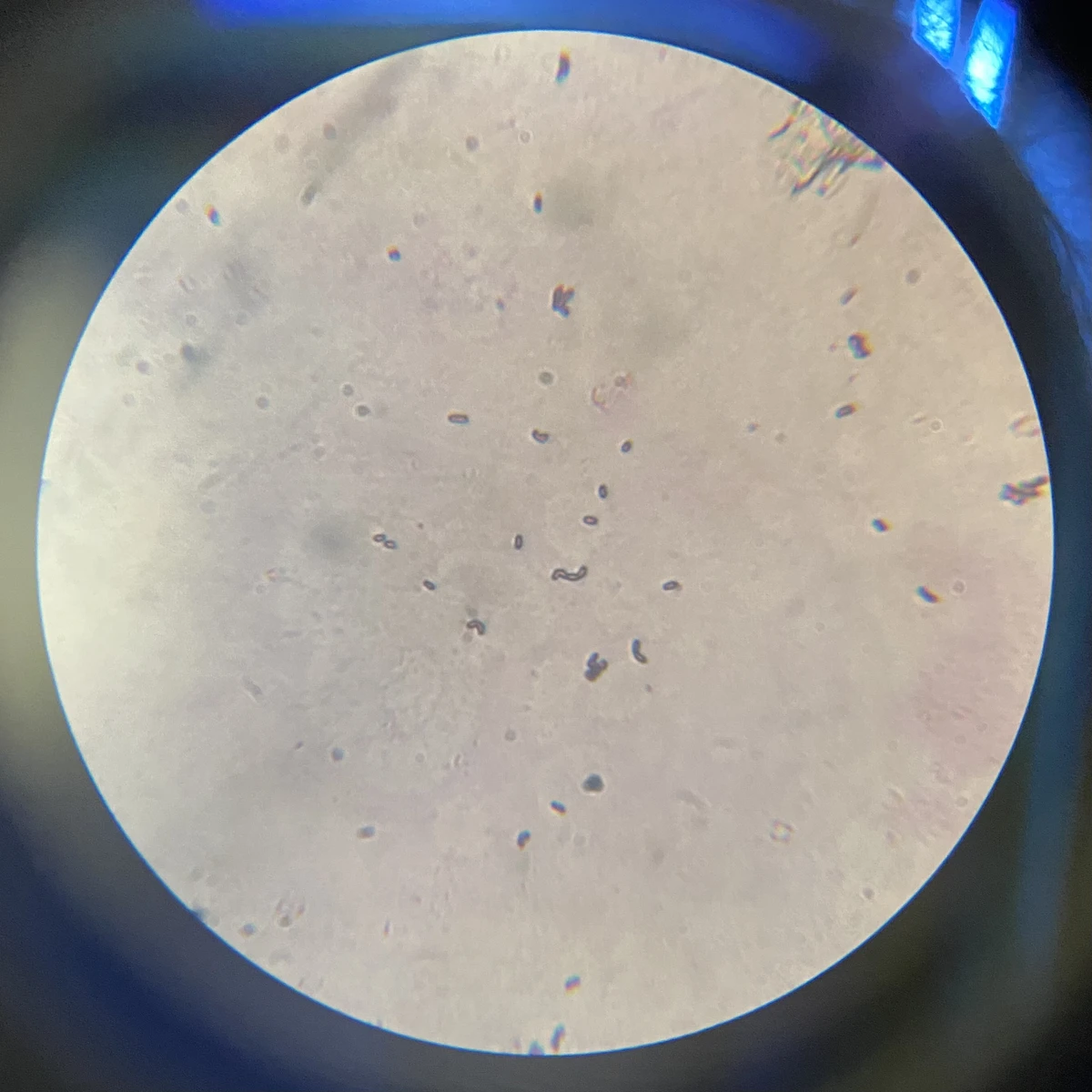 internship-dbeb-iitd-17-left-gram-stained-sample